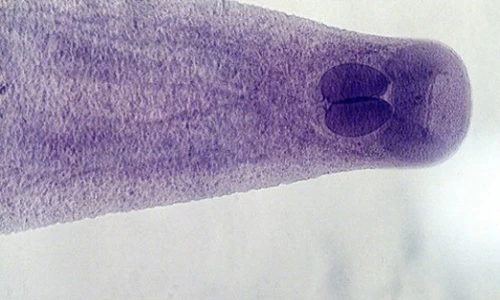 Ảnh “hiền khô” của ký sinh trùng đáng sợ trong thức ăn