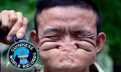 Những dị nhân có khả năng không tưởng (2)