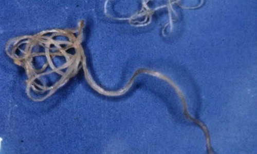 Ghê tởm những loài ký sinh độc ác nhất hành tinh 