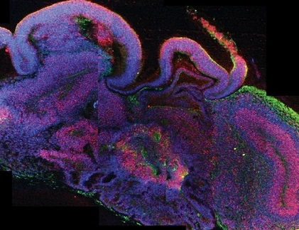 Top đột phá khoa học khủng nhất năm 2013