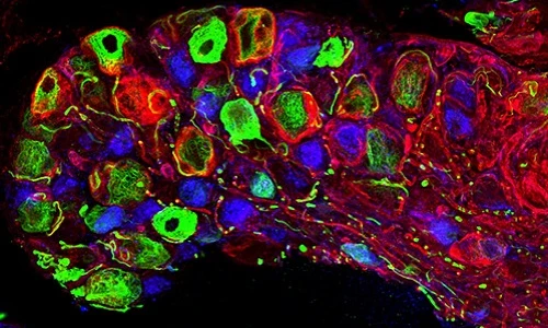 Dây thần kinh thay đổi thế nào khi chịu tác động?