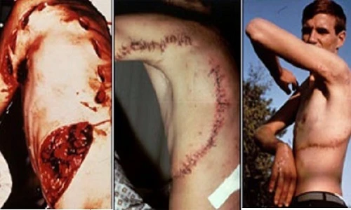 Những vụ cá mập tấn công người gây ác mộng nhất (1)