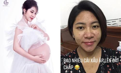 Nhan sắc Đặng Thu Thảo lúc bầu thế nào... chồng chê xấu, ngoại tình?