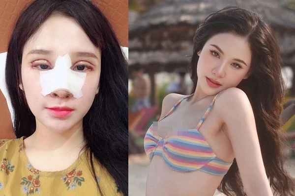 Yến Tatoo lên đời nhan sắc sau 5 năm phẫu thuật thẩm mỹ