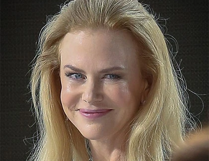 Rùng rợn khuôn mặt bóng nhờn vì botox của Nicole Kidman