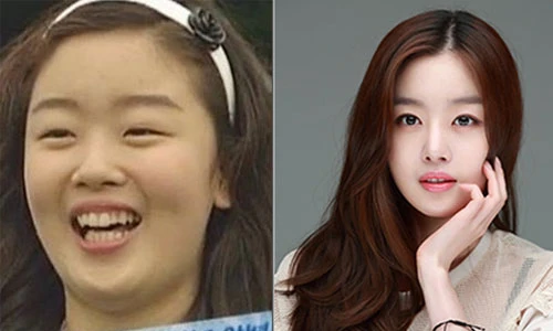 Ảnh gây sốc về nhan sắc thời quá khứ của sao Hàn