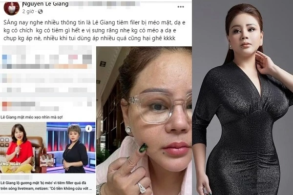 Lê Giang khoe nhan sắc thật bác tin đồn tiêm filler bị méo mặt