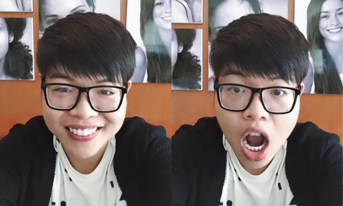 Đức Phúc The Voice khoe "nhan sắc" mới sau chỉnh sửa răng