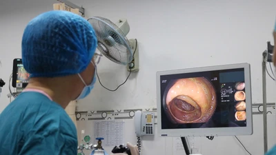 Bệnh viện Đa khoa Ninh Thuận tiếp nhận kỹ thuật nội soi tiêu hóa hiện đại