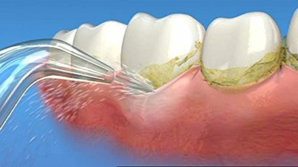 Thế nhưng do tiếp xúc với mùi này một thời gian dài, não bộ không “phản ứng” với nó nữa.