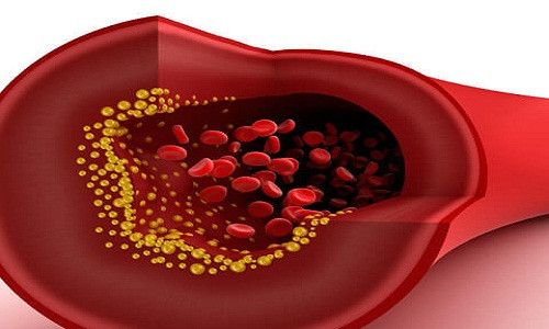 3. Giúp điều chỉnh Cholesterol trong cơ thể Cây kế sữa có lợi cho sức khỏe tim mạch và giúp điều chỉnh nồng độ cholesterol bằng cách giảm viêm, làm sạch máu và ngăn ngừa tổn thương oxy hóa trong các động mạch.
