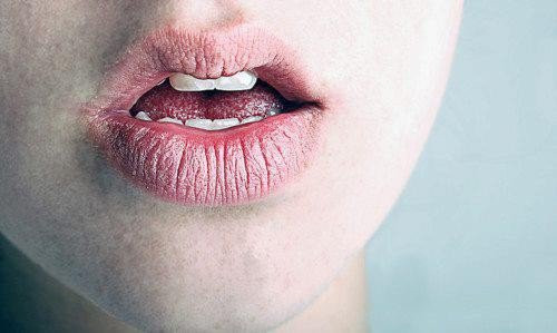 Môi khô nứt nẻ. Hiện tượng môi khô nứt nẻ thể hiện cơ thể đang thiếu vitamin B và B6. Những chất này đóng vai trò ngăn ngừa bệnh tim mạch, loãng xương và trầm cảm. Bạn nên bổ sung các loại thực phẩm như cà rốt, thịt gà, trứng, cá, thịt, đậu Hà Lan, cải bó xôi, chuối, bông cải xanh và khoai tây.