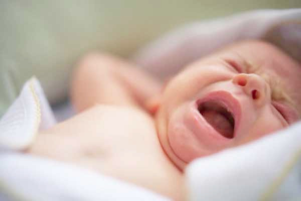 Bệnh vàng da. Nếu vàng da ở trẻ sơ sinh không được chữa trị thì mức độ bilirubin rất cao trong máu có thể gây ra tổn thương não. Tuy nhiên, vàng da ở trẻ sơ sinh thường được cha mẹ trẻ phát hiện và điều trị sớm, do đó các biến chứng này hiện nay đã trở nên rất hiếm. Trị bệnh này cho bé bằng cách đặt trẻ dưới ánh đèn vàng hoặc tắm nắng buổi sáng. Nhớ là phải che chắn mắt bé cẩn thận.