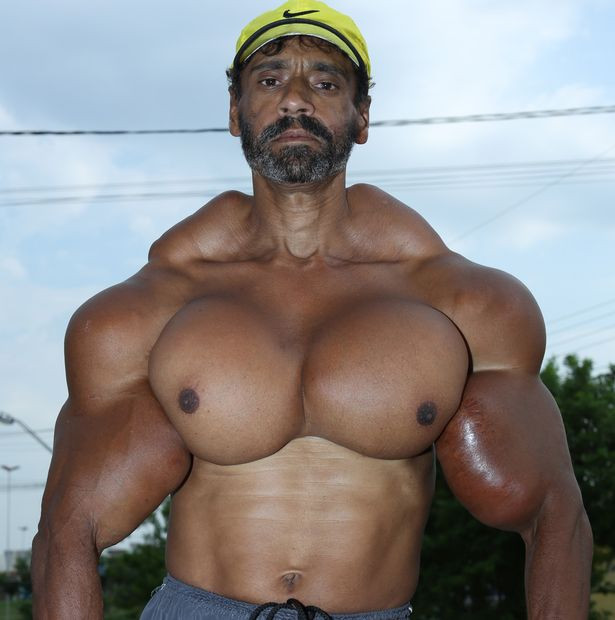 Ban đầu, Valdir đi tập gym và muốn tác dụng thật nhanh. Sau đó, ông được bạn bè tập gym cùng giới thiệu sử dụng synthol, một loại chất kích thích tăng cơ độc hại.