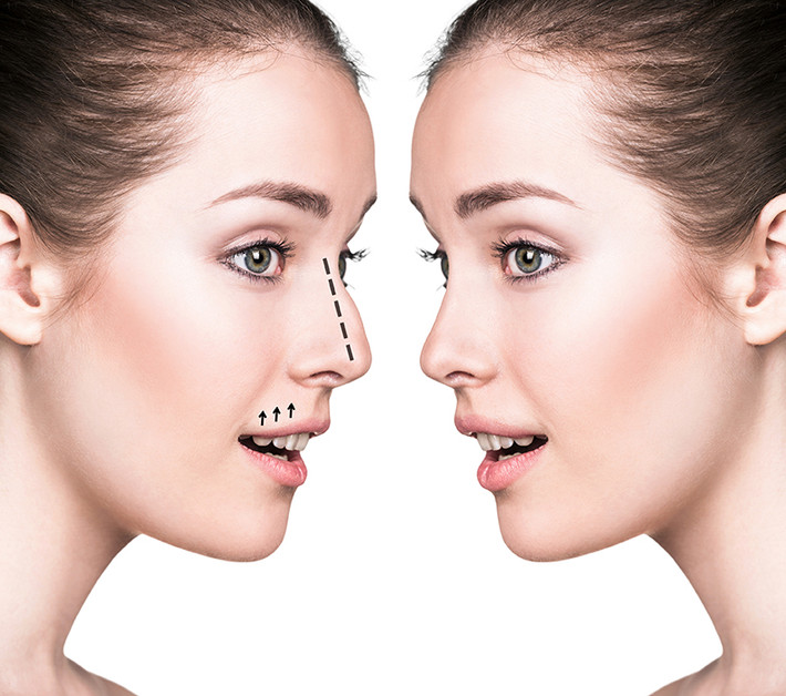 Bạn cũng nên thăm khám đầy đủ theo lịch trình bác sĩ đã đề ra sau phẫu thuật ngay cả khi bạn cảm thấy tình trạng sức khỏe của mình tốt và trải qua quá trình phục hồi nhanh chóng. Ảnh: medisetter.