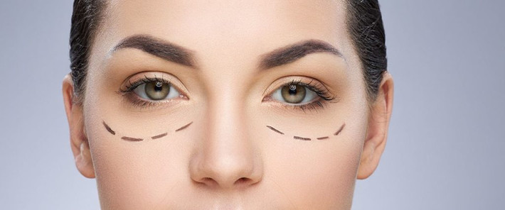 Trước khi phẫu thuật, bạn sẽ được hướng dẫn chi tiết về những việc bạn nên thực hiện. Vì vậy, hãy bảo đảm rằng bạn sẽ thực hiện theo tất cả các hướng dẫn này để cuộc phẫu thuật cắt mí mắt đạt kết quả tốt nhất. Ảnh: cloudfront.