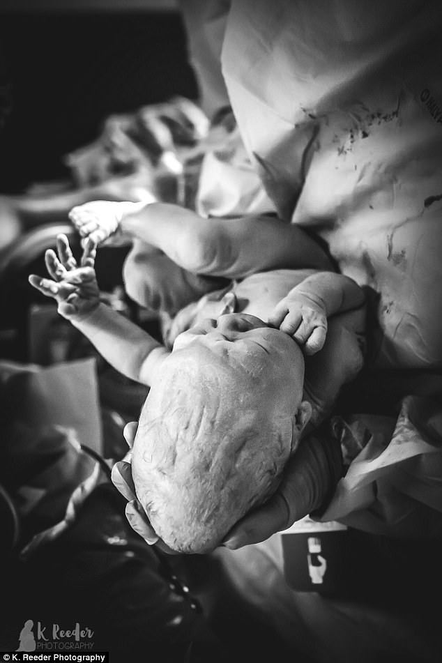 Khi một đứa trẻ ra đời, chúng có những chấm mềm, gọi là fontanelle, trên đầu của chúng. Hộp sọ của trẻ sơ sinh không hình thành hoàn thiện ngay từ khi sinh ra mà thay vào đó là một số mảnh xương sọ được nối với nhau bằng mô mềm.