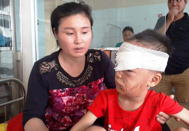 Tháng 11/2018, bệnh viện Nhi Thanh Hóa tiếp nhận và điều trị cho một bệnh nhi bị chó cắn trong tình trạng có nhiều vết thương vùng mặt, mũi, đầu và nguy hiểm nhất là tổn thương vùng hốc mắt, đứt ống tuyến lệ. Nạn nhân là cháu Nguyễn Đình Đ. (6 tuổi), trú tại xã Mai Lâm, huyện Tĩnh Gia, tỉnh Thanh Hóa. Theo gia đình cháu Đ. cho biết, khi cháu đang chơi ngoài ngõ, mẹ cháu có nghe hàng xóm hô hoán con chị bị chó cắn. Ngay lập tức, chị liền chạy ra thì vô cùng hoảng hốt khi chứng kiến mặt con mình bê bết máu. Cháu Đ. bị chính chó nhà tấn công.