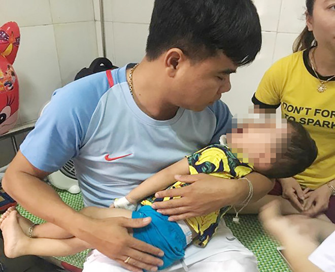 Đây là hình ảnh bé Ngô Đức V. H. (2 tuổi), trú xã Diễn Kỷ, Diễn Châu bị chó nhà cắn, rất nhiều vết thương ở cằm, má phải, cánh mũi phải và đặc biệt ở vùng mi trên và mi dưới mắt phải có nhiều vết rách phức tạp, nguy hiểm. Theo người thân cháu bé, khi bé H. đang chơi và ăn bim bim thì bị con chó đuổi vờn theo. Bé H. dùng tay xua đuổi thì bị chó lao vào tấn công, cắn, cào vào mặt và đầu. Người nhà đã chạy đến cứu bé H. đưa đi bệnh viện cấp cứu.