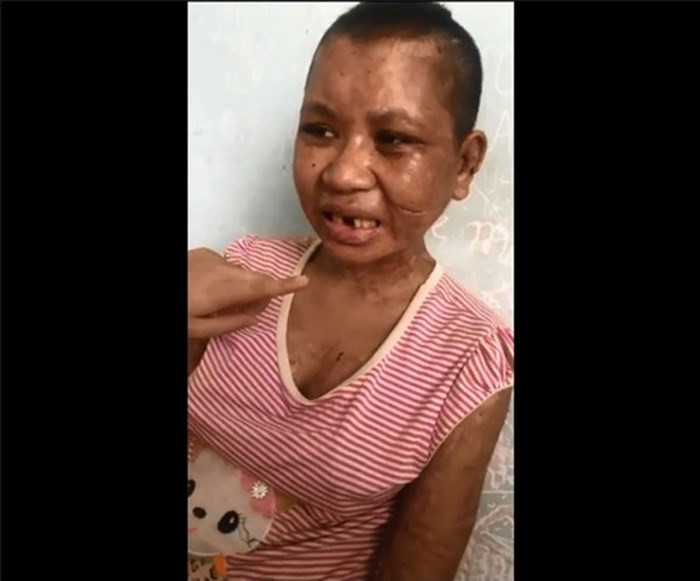 Y Nhiêu nghẹn ngào kể lại cái thai của chị với bạn trai (khoảng 5 tháng) vì bị bà chủ đánh đập nhiều quá nên đã chết luôn trong bụng. Bà Nga liên tục đánh và đạp vào bụng chị và nói "nếu là con của chồng tao thì tao giữ, còn không thì tao đập cho chết". Khi Y Nhiêu bị đau bụng, ra máu, bà Nga bắt chị mang con chôn ở bãi đất trống gần nhà. (Ảnh: Lao Động)