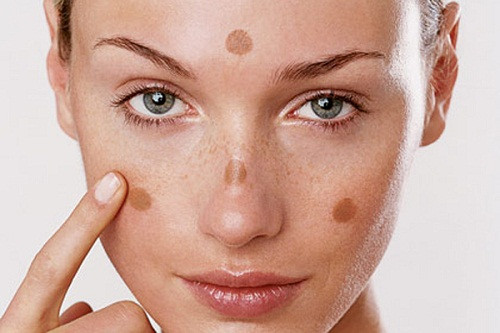 Làm mờ vết sạm da, vết đốm nâu, vết nám do vitamin C có tác dụng ngăn chặn sự hình thành và làm mờ sắc tố melanin. Ảnh: youtube.com.