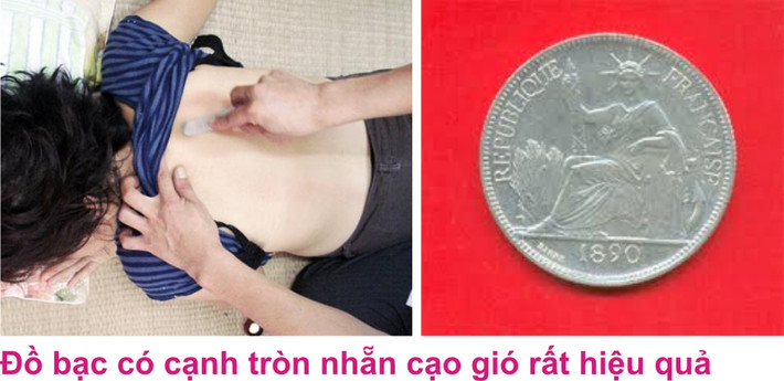 Dùng bạc hay đồng tiền bằng bạc: Chọn những vật dụng bằng bạc, hình tròn, bề mặt nhẵn, vật dụng làm bằng bạc có tác dụng phát tán và lưu thông khí huyết. Dùng khăn mùi xoa bọc miếng bạc hay đồng tiền bạc cùng lòng trắng trứng gà vừa luộc xong chà xát lên người bệnh từ trên xuống, làm liên tục từ 10-20 phút. Ảnh: hongoccan2015.wordpress.com.