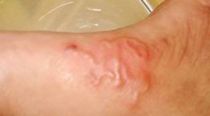 Chữa bệnh sán máng, sưng gan, lách. Dùng rễ hoa đồng tiền 30g sắc với 3 lít nước, còn 1 bát, uống 1 lần, liên tục uống như vậy trong 7 ngày. Ảnh: Zingnews.