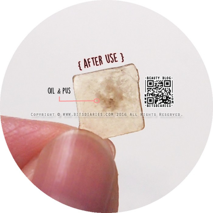 Miếng dán mụn có thiết kế đặc biệt, hình tròn, nhỏ xíu và trong suốt. Bạn có thể dùng nó dán lên vết mụn. Vết mụn sẽ khô lại và nhân mụn theo miếng dán ra ngoài. Tùy từng loại mụn sẽ có kích cỡ phù hợp.
