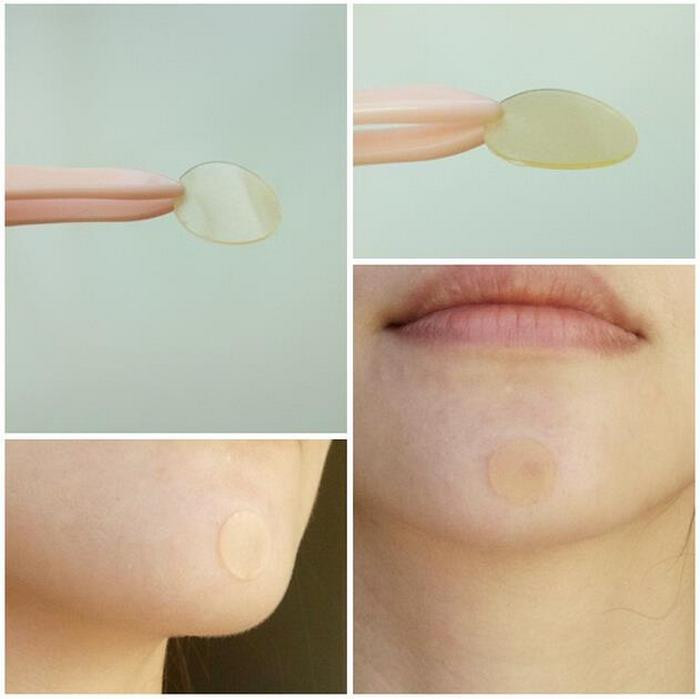 Miếng dán mụn có vai trò như một lớp bảo vệ để mụn không tiếp xúc với môi trường bụi bặm đầy vi khuẩn. Miếng dán cũng có thể hút sạch nhân mụn bởi nó có thể lôi được cả mủ sâu dưới sâu. Ảnh: Aliexpress.