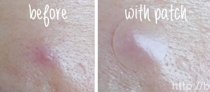 Bạn có thể tẩy trang và rửa mặt thoải mái khi sử dụng miếng dán mụn bởi nó vô cùng chắc chắn.