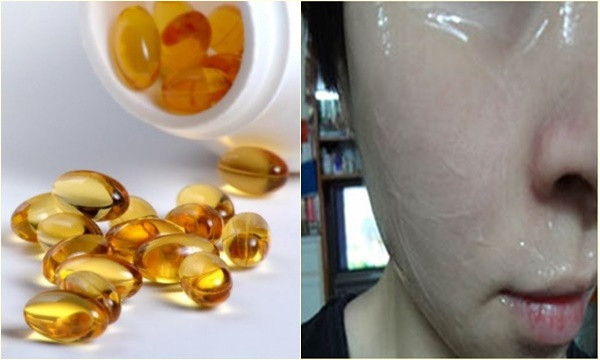 Có thể dùng viên nang vitamin E bôi trực tiếp lên da mặt cũng rất tốt, những vết thâm sẹo do mụn để lại cũng nhanh chóng biến mất. Thực hiện đều đặn 1 - 2 tháng. Ảnh: trivettham.net.