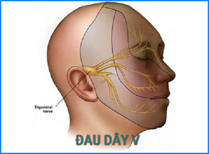 Hỗ trợ cho người bị yếu dây thần kinh. Rất đơn giản, dùng 3 lá dứa còn xanh tươi, rồi đem rửa sạch, cắt nhỏ, nấu cùng 3 chén nước, đun cho đến khi còn lại 2 chén. Chia làm 2 phần, một phần uống bữa sáng và một phần uống vào buổi trưa sẽ rất tốt cho dây thần kinh. Ảnh: Suckhoe. (Thông tin trong bài viết chỉ mang tính chất tham khảo. Trước khi sử dụng bài thuốc, bạn vui lòng hỏi ý kiến bác sĩ).