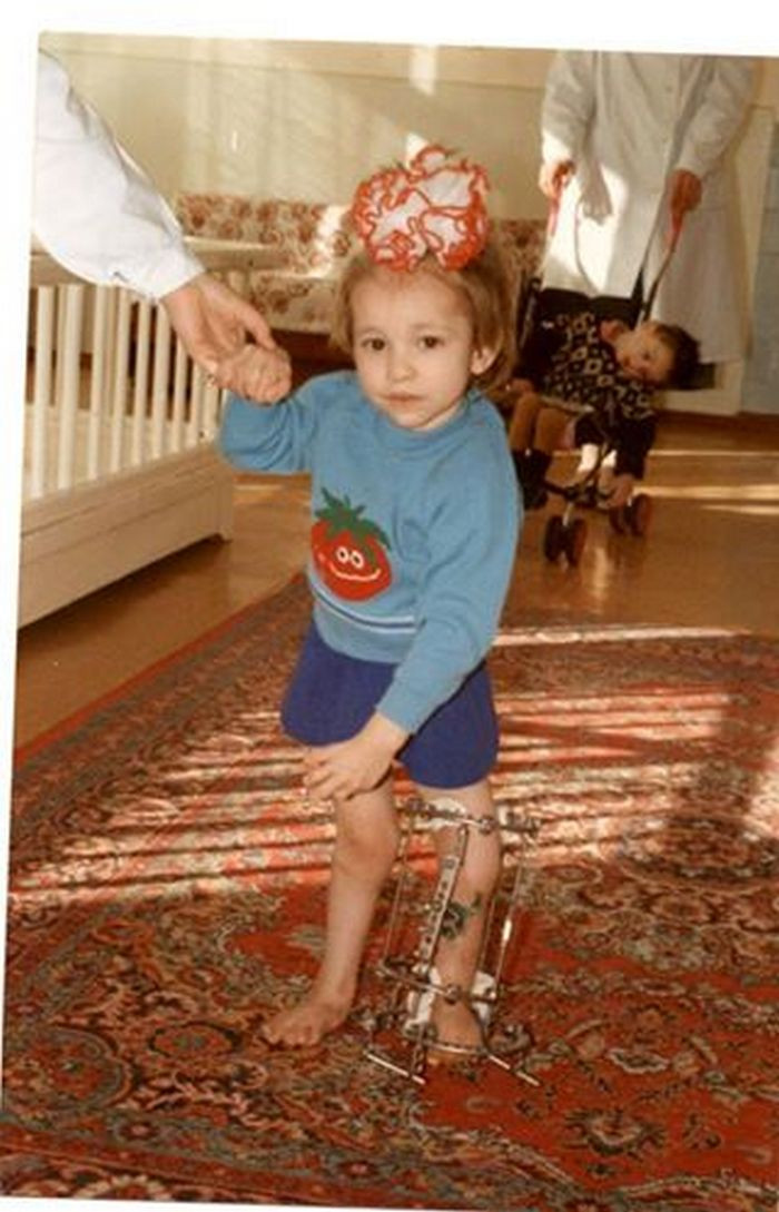 Oksana Bondarchuk sinh năm 1989 tại một thành phố xinh đẹp của Ukraina. Khi vừa chào đời, bác sỹ đã sốc khi nhìn thấy hai chân của đứa trẻ bị biến dạng. Bàn tay của Oksana cũng bị méo mó và thiếu một ngón.