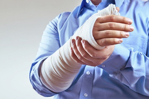 Chữa gãy xương: Vỏ duối giã nhỏ với lá thanh táo, dây tơ hồng và chuối tiêu, đắp bó bên ngoài nơi gãy xương. Ảnh: Bệnh viện Đa khoa Quốc tế Thu Cúc.