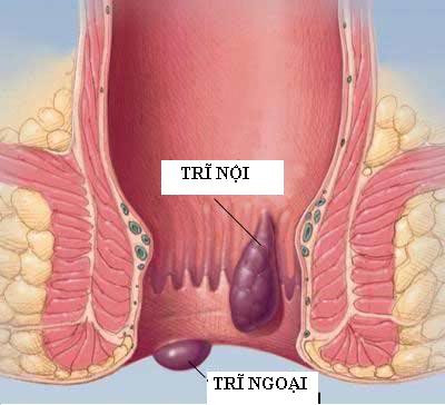 7. Giúp thanh nhiệt, săn chắc cơ, thích dụng cho các chứng trĩ, sa trực tràng, sa dạ con: Lá dâu 16 - 18g sắc, đợi nước còn nóng ấm rửa búi trĩ, trực tràng… và đẩy lên, lấy băng băng lại, nằm nghỉ. Ảnh: duocphamvinhgia.vn.