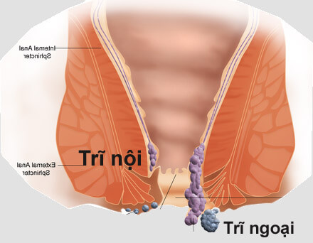 Chữa sa trực tràng (lòi dom), trĩ hậu môn, ỉa ra máu: Sắc cả hoa và hạt với liều 15g với 3 bát nước, lấy 1 bát uống nguội, uống 3 lần/ngày, hoặc phơi khô, tán thành bột, làm viên nhỏ như hạt đậu, uống nhiều lần thành đợt điều trị. Ảnh: cachchuabenhtri.org.