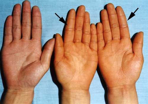 9. Viêm gan vàng da: Nghệ đen, nghệ vàng, cỏ cú, quả tắc non, tất cả đồng lượng, phơi khô tán bột, trộn với mật ong làm viên uống ngày 1-2g. Ảnh: Corbicula. (Thông tin trong bài chỉ mang tính chất tham khảo, trước khi sử dụng bài thuốc, bạn vui lòng hỏi ý kiến bác sĩ).
