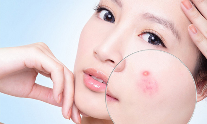 Giảm cân. Đun sôi rượu vang và quả mận đã sấy khô trong nồi đậy vung thật kín. Dùng nước này như nước uống giảm cân. Rượu mận cũng giúp giữ nhiệt cho cơ thể rất tốt. Ảnh: Meotrimun.