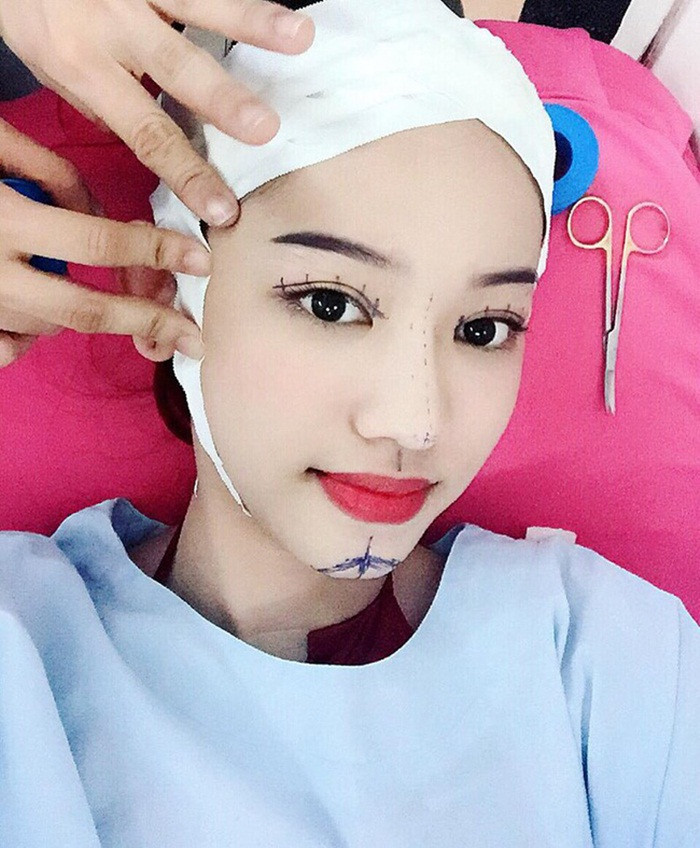 Tuy thế, cô nàng chẳng bao giờ hài lòng với kết quả thẩm mỹ của mình. Thúy Vi lại tiếp tục đăng ảnh đi tìm sắc đẹp hoàn mỹ khi đang nằm trên bàn mổ của thẩm mỹ viện. Ảnh: FBNV.