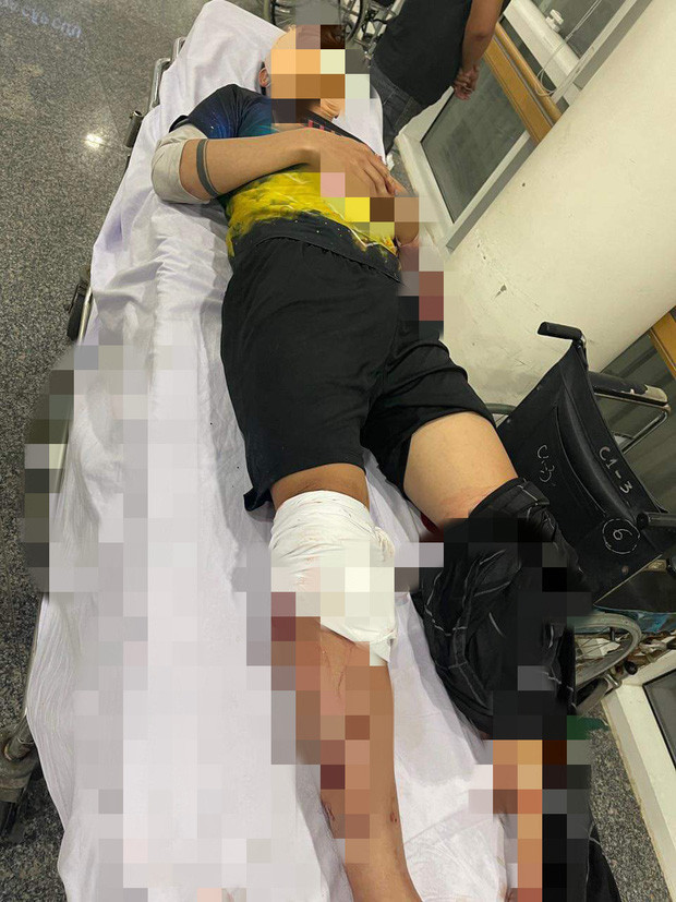 Mâu thuẫn trong lúc đá bóng, một thanh niên bị chém gục: Chiều 17/11/2021, anh Trần Văn K. (22 tuổi) cùng nhóm bạn đến sân bóng ở ấp 6, xã Bình Mỹ (TPHCM) để đá bóng. Trong lúc đá bóng, hai bên xảy ra mâu thuẫn nhỏ. Khi trận đấu kết thúc, đội bạn ra về còn anh K. cùng bạn ngồi lại uống nước thì bất ngờ có một nhóm thanh niên cầm hung khí từ ngoài tới lao vào tấn công. Anh K. bị chém gục tại chỗ, được đưa đi cấp cứu trong tình trạng vỡ xương sọ, đứt hai gân chân, nhiều vết chém sâu ở cơ thể. (Ảnh: Vietnamnet)