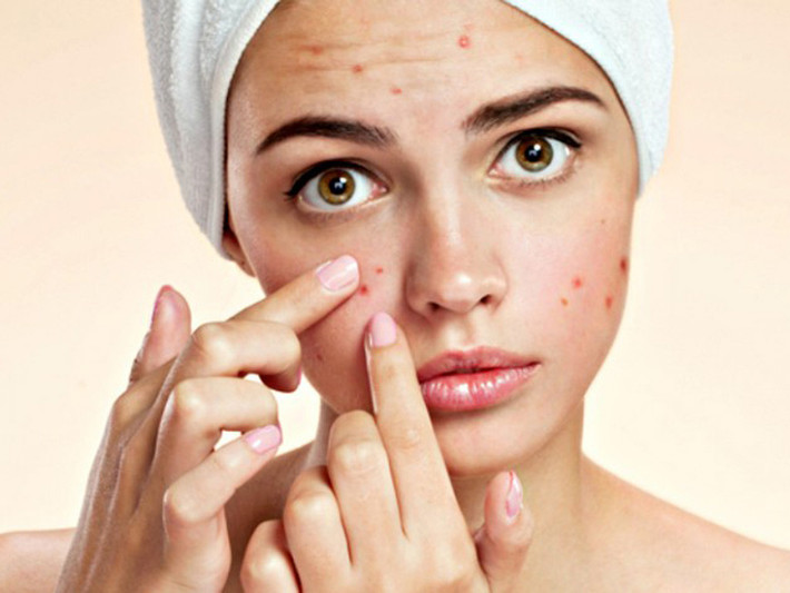 Trị mụn. Rau má được rửa sạch và cho vào máy xay sinh tố nghiền nhuyễn, đổ thêm nước ấm. Chắt lấy nước uống và bã dùng để đắp lên vết mụn. Đắp thường xuyên thì vết mụn sẽ mờ nhanh chóng. Ảnh: phunutoday.