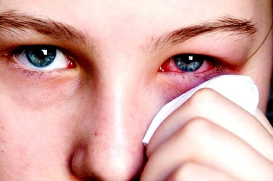 Thậm chí, các bác sĩ chuyên khoa còn cảnh báo nếu ăn tôm khi đang bị đau mắt đỏ, còn làm tình trạng bệnh trở nên trầm trọng hơn. (Nguồn Healthplus)