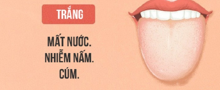 Lưỡi có lớp phủ kín màu trắng. Tùy vào tình trạng của lớp phủ màu trắng mà bạn có thể đang đối diện với nguy cơ sức khỏe khác nhau. Lưỡi bị phủ kín màu trắng có dịch nhờn chỉ ra dấu hiệu của bệnh tim mạch vành. Trường hợp màu lưỡi bất thường kèm suy nhược cơ thể là dấu hiệu thiếu máu. Nếu lớp phủ trắng bình thường lại là dấu hiệu của mất nước, nhiễm nấm hoặc cúm.