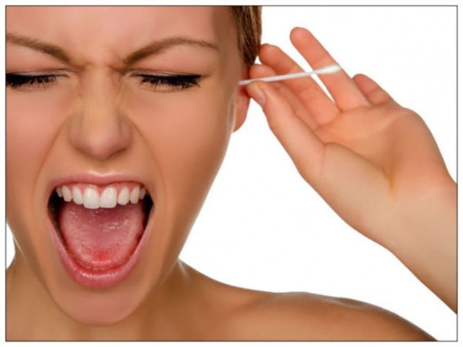 Nhiều người còn đưa dụng cụ vào quá sâu trong tai gây tổn thương, thậm chí làm thủng màng nhĩ, gây giảm thính lực. (Nguồn Vov)