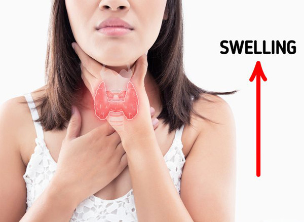 Kiểm soát tuyến giáp: Mặt sưng phù có thể thể do tuyến giáp hoạt động kém. Lúc này, cơ thể sẽ trở nên mệt mỏi, tăng cân và táo bón. Tốt nhất, bạn nên đi khám để phát hiện và có cách điều trị sớm.