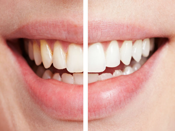 Chăm sóc răng miệng. Những người bị hôi miệng có thể uống trà bạc hà để có hơi thở thơm mát hơn. Uống trà bạc hà thường xuyên có thể giúp chấm dứt tình trạng hôi miệng, điều khiến bạn khó chịu hay xấu hổ.