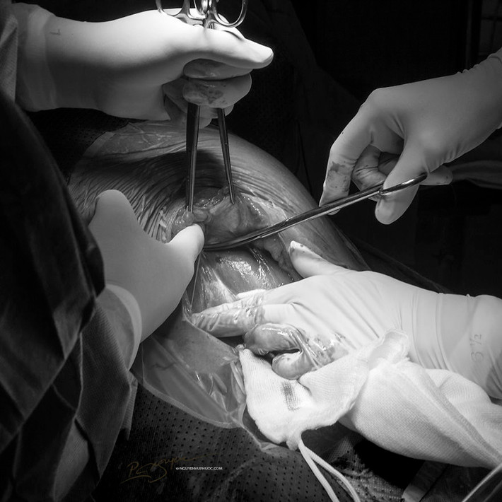 Nhiếp ảnh gia hy vọng dự án này sẽ truyền đi thông điệp rằng tất cả mọi phụ nữ đều xinh đẹp, đặc biệt là họ còn đẹp hơn khi họ mang thai. "Tôi cũng hy vọng rằng dự án này sẽ gửi đi một thông điệp khác đến với tất cả mọi người rằng, cuộc sống sẽ đẹp hơn khi chúng ta có những người mẹ, bởi họ xứng đáng được tôn vinh", nhiếp ảnh gia chia sẻ.