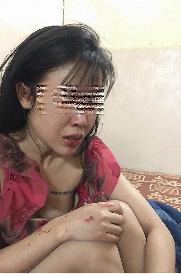 3. Bị chồng đánh đến tàn tạ giữa đường Xã Đàn, Hà Nội, ngày 6/10/2018, nhiều trang diễn đàn mạng đăng tải loạt ảnh cô gái xinh đẹp được cho là bị chồng đánh tại đường Xã Đàn vào sáng sớm cùng ngày đã khiến cộng đồng mạng không ngừng xôn xao và thương xót.