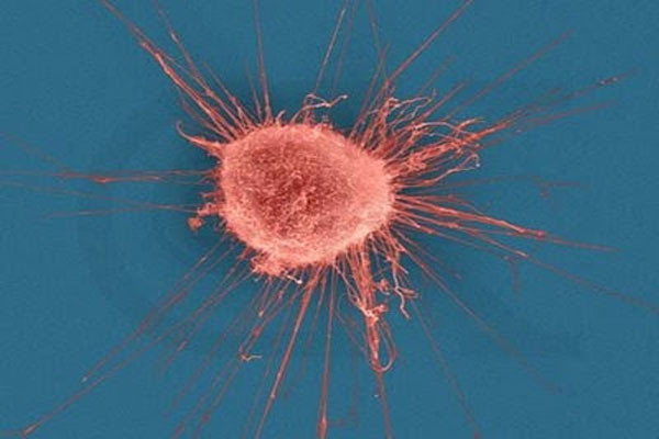 Một nghiên cứu mới được công bố trên Tạp chí Cell Biology, các nhà khoa học cho thấy, một loại protein có tên DENND2B trong các tế bào của cơ thể sẽ làm cho hiện tượng di căn của ung thư nhanh hơn bình thường.