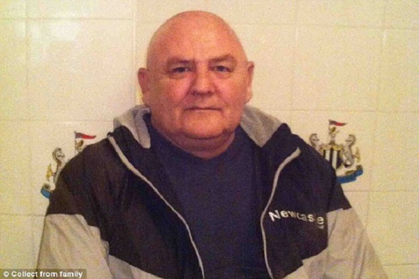 Ông Raymond Martin, 64 tuổi bị một dạng ung thư lạ có tên là angiosarcoma (ung thư mạch máu ác tính) trên mặt. Angiosarcoma (AS) là khối u ác tính đặc trưng bởi sự sinh sản nhanh và xâm lấn rộng của các tế bào biệt hóa có nguồn gốc từ các mô trong mạch máu.